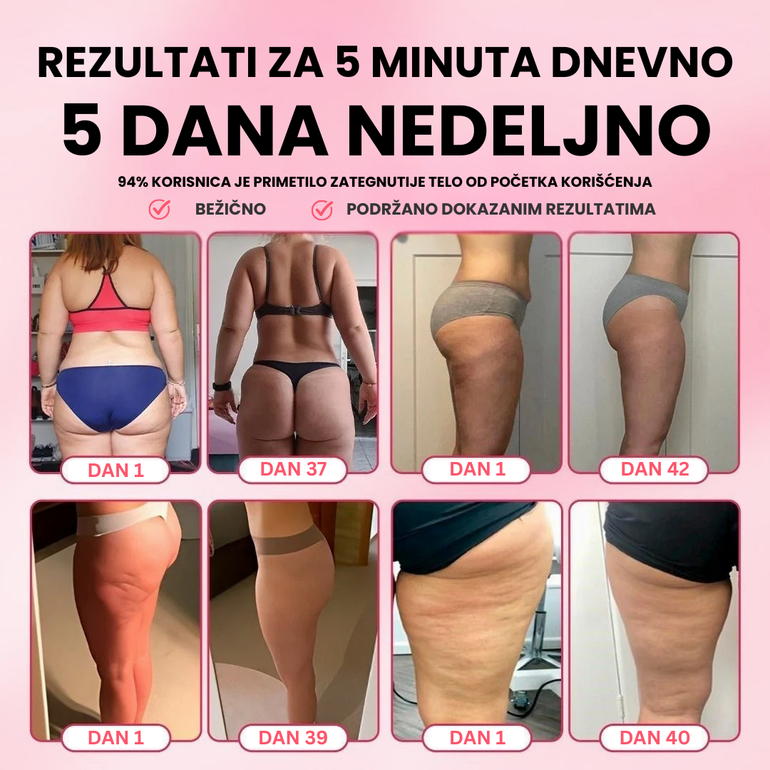 CelluLoss - Aparat Za Ublažavanje Celulita